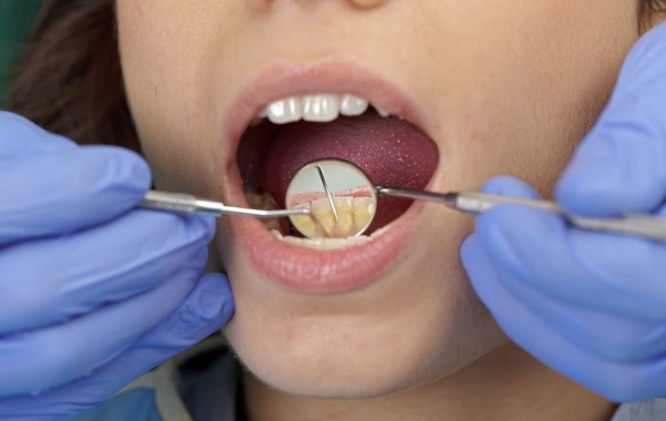 Paveikslėlis, kuriame yra asmuo, dantų šepetėlis, uždaryti, kosmetika Automatiškai sugeneruotas aprašymas